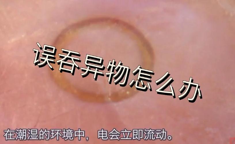 （误吞筷子怎么办）